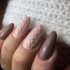 Epilation: A Permanent Solution for Beauty